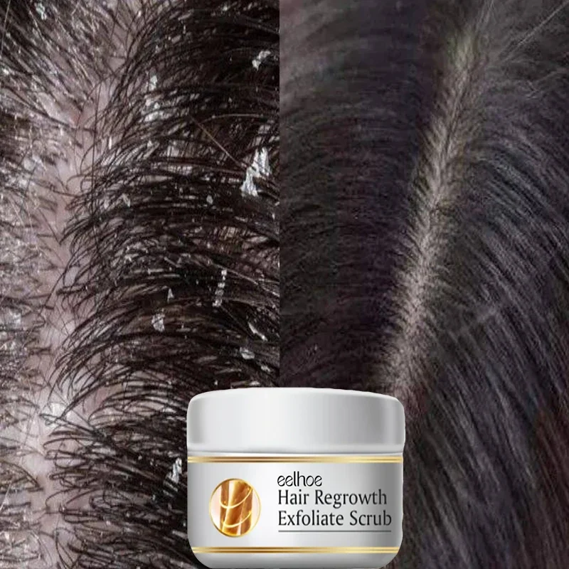 Fast Anti Dandruff Hair Treatm - đánh giá và giá Scalp Scrub Exfoliant