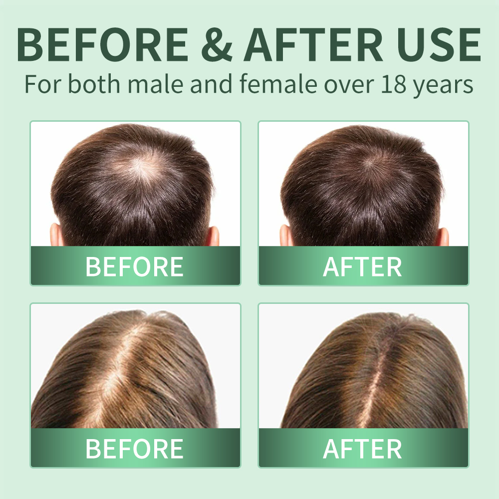 Hair Growth Spray,Scalp Scrub, - đánh giá và giá Scalp Scrub Exfoliant
