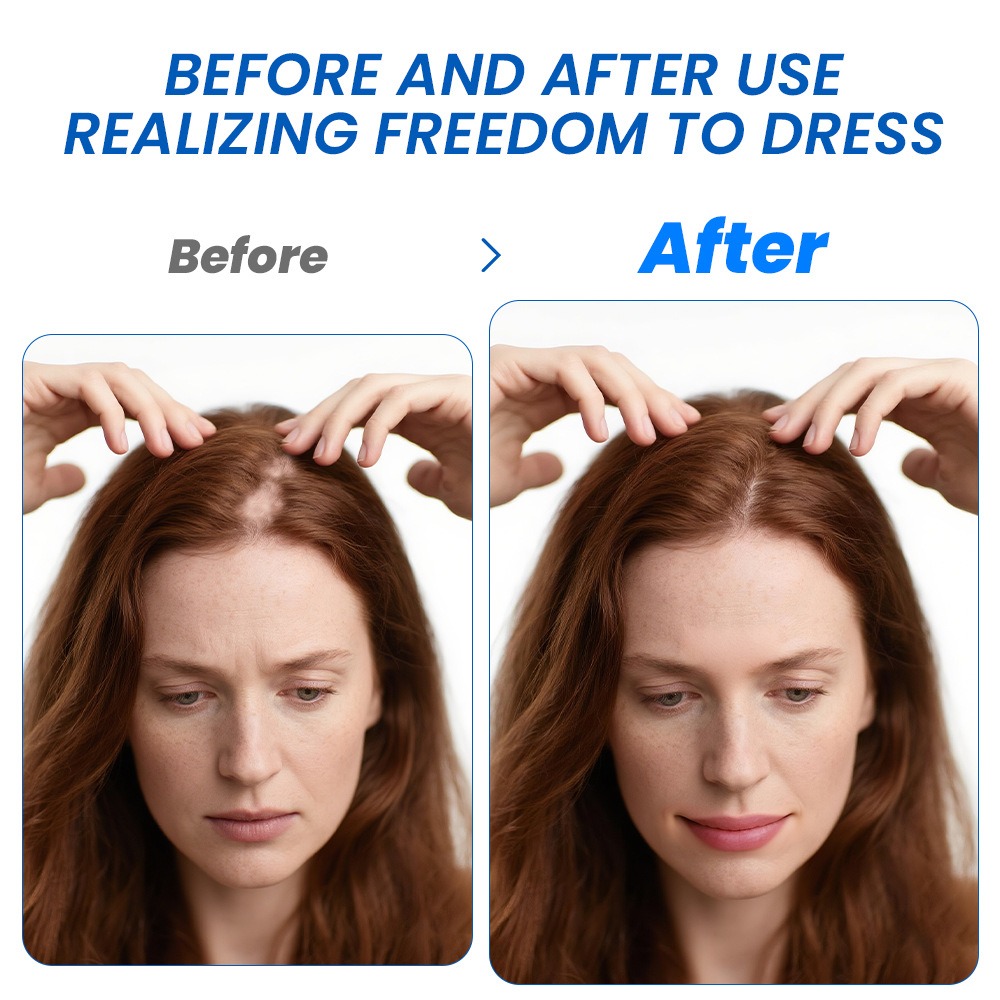 Alopecia Hair Growth Spray Sop - đánh giá và giá Hair Care Cream