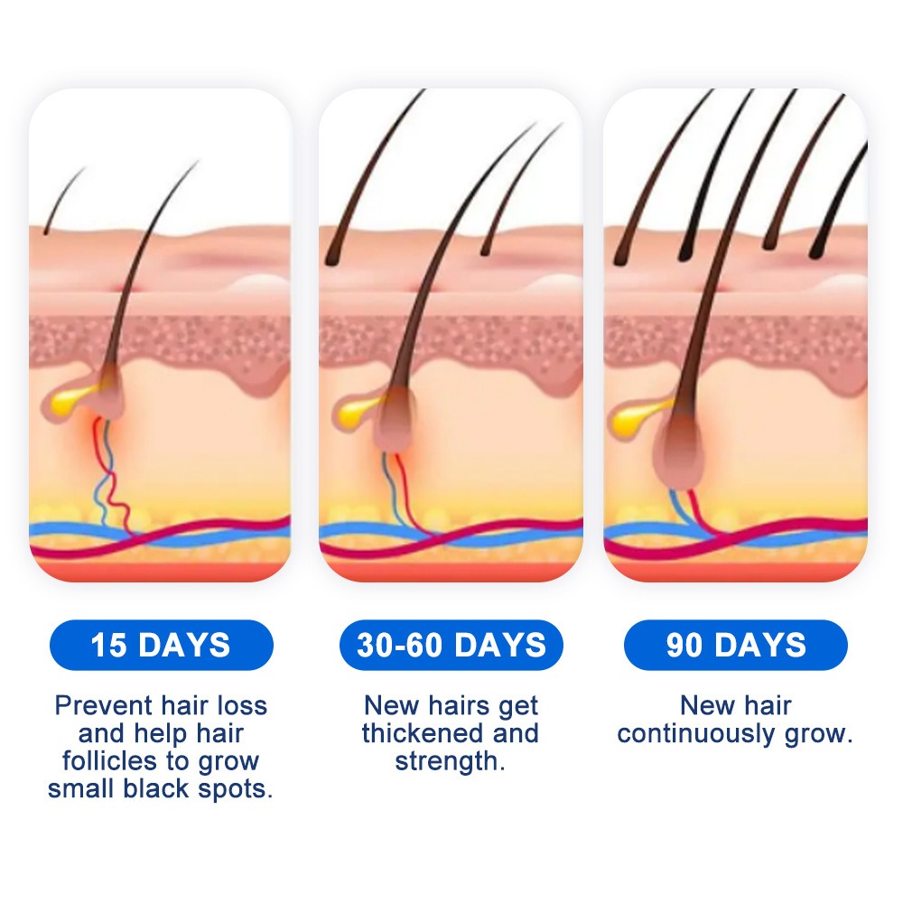 Alopecia Hair Growth Spray Sop - đánh giá và giá Hair Care Cream