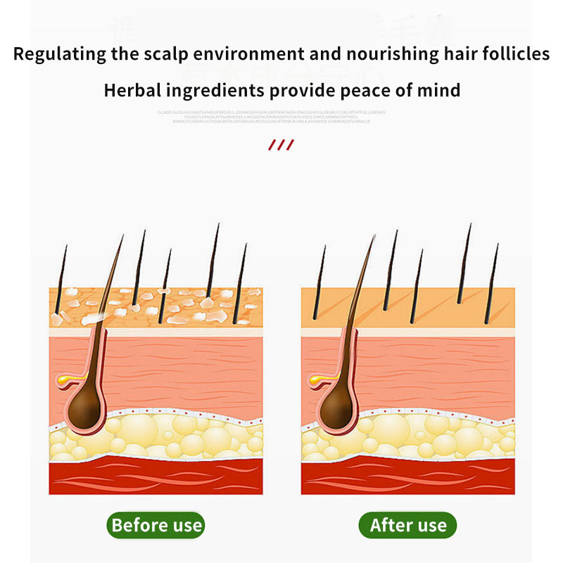 Sophora Flavescens Hair Follic - đánh giá và giá Hair Care Cream