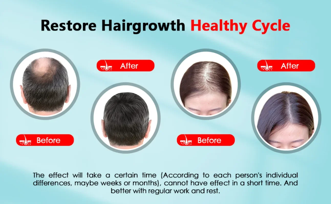 Hair Growth Cap Rechargeable 2 - đánh giá và giá Hair Care Vegan